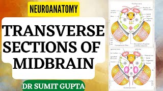 Transverse Sections of Midbrain  NEUROANATOMYTHE BRAINSTEM [upl. by Eimmak98]