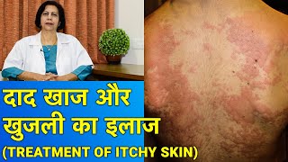 दाद खाज और खुजली का इलाज  Treatment of Itchy Skin [upl. by Gnad]