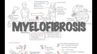 Primary Myelofibrosis  Overview presentation pathophysiology investigation treatment [upl. by Cirdahc]