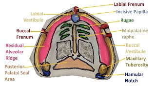 شرح Anatomical landmarks In Maxilla على Study cast [upl. by Tneicniv]