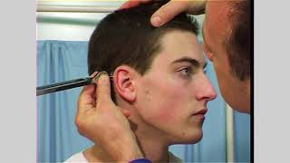 Vestibulocochlear nerve examination  Eighth cranial nerve [upl. by Maller]