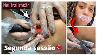 SEGUNDA SESSÃO DE NEUTRALIZAÇÃO LABIAL  DERMAPLANING  Sarah Gontijo [upl. by Etnaed14]