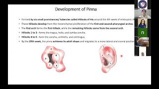 Surgical anatomy of Ear and Temporal bone  Dr Kaberi Kakati [upl. by Ellienad]