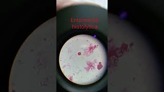 Slide of Entamoeba Histolytica microscopicshort videobiology [upl. by Penelopa]