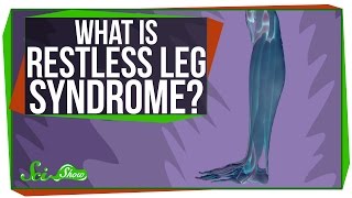 What is Restless Leg Syndrome [upl. by Furnary]