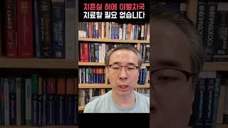 혀에 이빨자국은 치흔설 꼭 치료할 필요 없어 혀통증 구강작열감증후군 [upl. by Annaig]