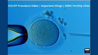 ICSI IVF Procedure Video  Important things  RSMC Fertility Clinic [upl. by Stoecker]