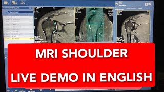 Shoulder MRI scan protocol positioning and planning on GE 15 Tesla  Live Demo in English [upl. by Reginauld197]