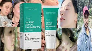 Dermatouch Salicylic Acid Niacinamide Oil Free Gel  Honest Review [upl. by Jenks]