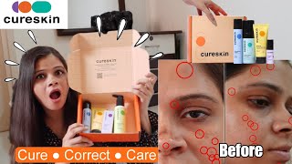 Cureskin App amp Products Review amp Everything In Between  Honest Cureskin Review  Kamna Sharma [upl. by Mosley]