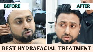 Best Hydra Facial in Dhaka  Hydrafacial Dhanmondi  Hydra Facial price in Parlour  Bio HydraFacial [upl. by Yntirb]