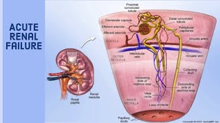 Acute renal failure prerenalrenal and post renal azotemia [upl. by Ahsienom108]