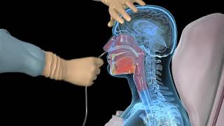 How to insert a nasogastric tube for NG intubation  3d animation [upl. by Meng]