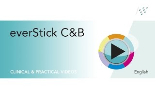 Clinical case using everStick® CampB [upl. by Stockmon]