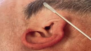 Ear 👂 cleaningnitpicking ASMR  whispers 🤫  KrissySkin [upl. by Simaj929]