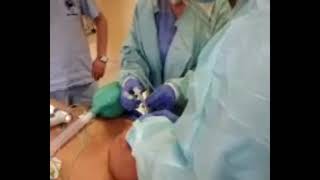 Airway Management During a Difficult Intubation Case [upl. by Thadeus]