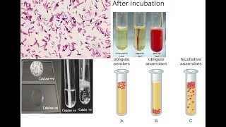 Clostridium botulinum Part 1 Biochemical Properties types of botulism and production of toxin [upl. by Vanden799]