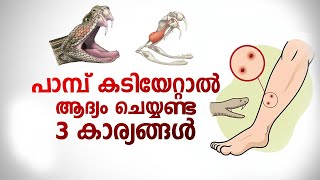 പാമ്പ് കടിയേറ്റാൽ ആദ്യം ചെയ്യണ്ട 3 കാര്യങ്ങൾ  Snake Bite Malayalam [upl. by Onivag]