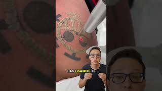 Removendo Tatuagem 😯🖊️ curiosidades curiosidademedicina medicina medico tattoo tatuagem [upl. by Amleht]