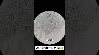 Pimples at 400X magnification are really cool underthemicroscope beefcut scienceshorts [upl. by Fortunato]