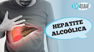 HEPATITE ALCOÓLICA E CIRROSE SINTOMAS DIAGNÓSTICO E TRATAMENTO [upl. by Honeywell784]