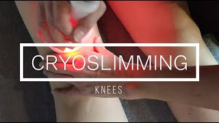 Cryoskin Révolution Tutorial cryoslimming knees session [upl. by Schlenger406]