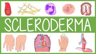 Scleroderma [upl. by Ahsiek749]