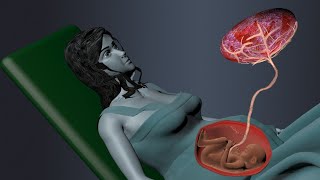 Fertilization Development of Placenta Labor and Delivery 3D Animation [upl. by Dosh]