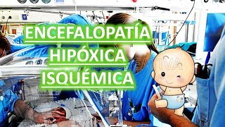 ENCEFALOPATÍA HIPÓXICA ISQUÉMICA [upl. by Neeliak534]