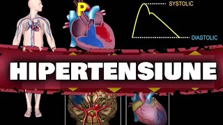 CAUZELE REALE ALE TENSIUNII ARTERIALE MĂRITE [upl. by Gothard]