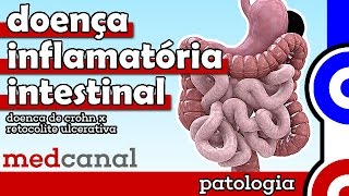 Doença Inflamatória Intestinal  PATOLOGIA [upl. by Leila]