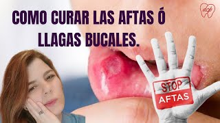 AFTAS en la boca causas REMEDIOS CASEROS🦷 SÚPER EFECTIVOS ✅ [upl. by Proudman]