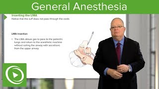 General Anesthesia – Anesthesiology  Lecturio [upl. by Bainbridge362]