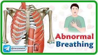 Accessory muscle Breathing Agonal Breathing Apneustic breathing Asterixis and Biots Breathing [upl. by Mcconnell]