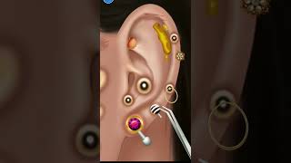 Asmr ear wax removal asmr asmrvideo shorts earringsanimation [upl. by Ilyssa]