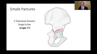 Kasr Al Ainy Postgraduate Orthopaedic Review Course  Acetabular Fractures Principles of Management [upl. by Naraa18]