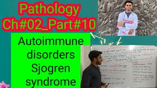 Autoimmune Disorders13Sjogren SyndromePathologyCh02Part10 [upl. by Yssep]