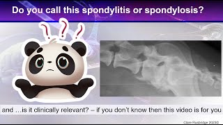 Bony spurs between the vertebrae  is is spondylosis spondylitis discospondylitis or DISH [upl. by Zenia]