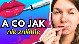 💋LEKARZ WYJAŚNIA Czy Grudki Po Kwasie Hialuronowym ZNIKNĄ SAME [upl. by Anawik]