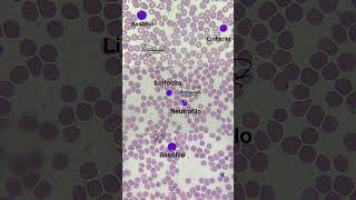 Morfología de leucocitos hematologia laboratorioclínico qfb [upl. by Eiddet264]