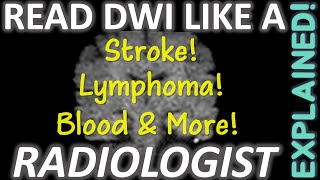 How to Read MRI Diffusion Imaging DWI like a Real Radiologist [upl. by Clair]