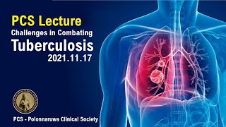 PCS Lecture  Challenges in Combating Tuberculosis 20211117 [upl. by Eiltan]