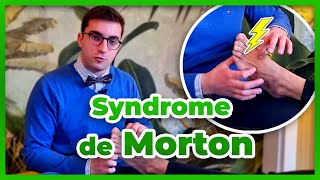 Syndrome de Morton  diagnostic prévention et traitement [upl. by Aneeuq466]