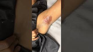 Satisfying underarm waxing results underarmwaxing eyebrows waxing shorts winnipeg viral [upl. by Ardaid]