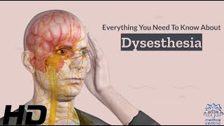 Dysesthesia 101 A Comprehensive Guide to this Mysterious Condition [upl. by Theis]