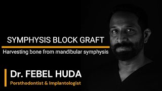 SYMPHYSIS BLOCK BONE GRAFT [upl. by Fleta]