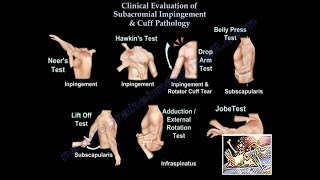 Clinical Examination Of Shoulder amp Rotator Cuff  Everything You Need To Know  Dr Nabil Ebraheim [upl. by Lubeck934]