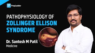 Pathophysiology of Zollinger Ellison Syndrome by Dr Santosh M Patil [upl. by Phenice]