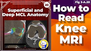 Fig 3A20 Superficial and Deep MCL Anatomy [upl. by Oniliuqnart]