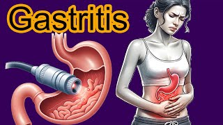 5 Early signs of Gastritis Gastritis diagnosis and treatment [upl. by Joashus]